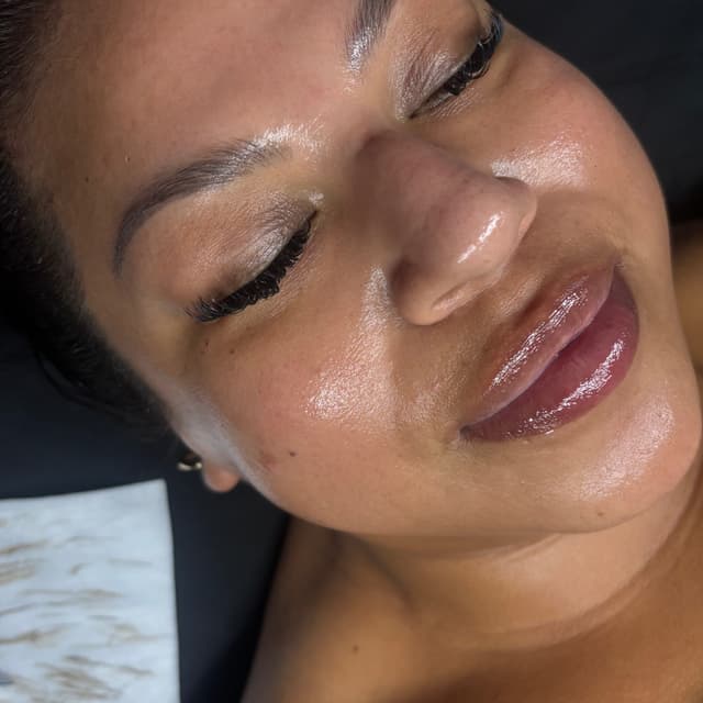 Dermaplaning 5-Session Package at Angelite Skin by Chloe in Anaheim, CA