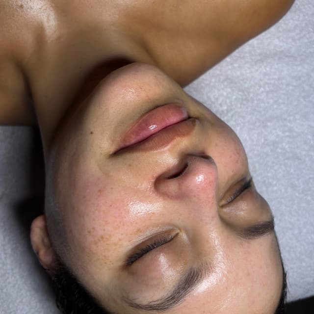 Signature Facial 3-Session Package at Angelite Skin by Chloe in Anaheim, CA